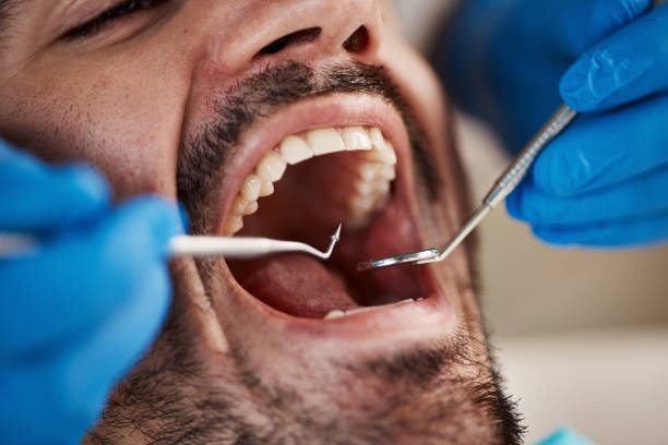 Best Weekend Emergency Dentist in Butler, OH